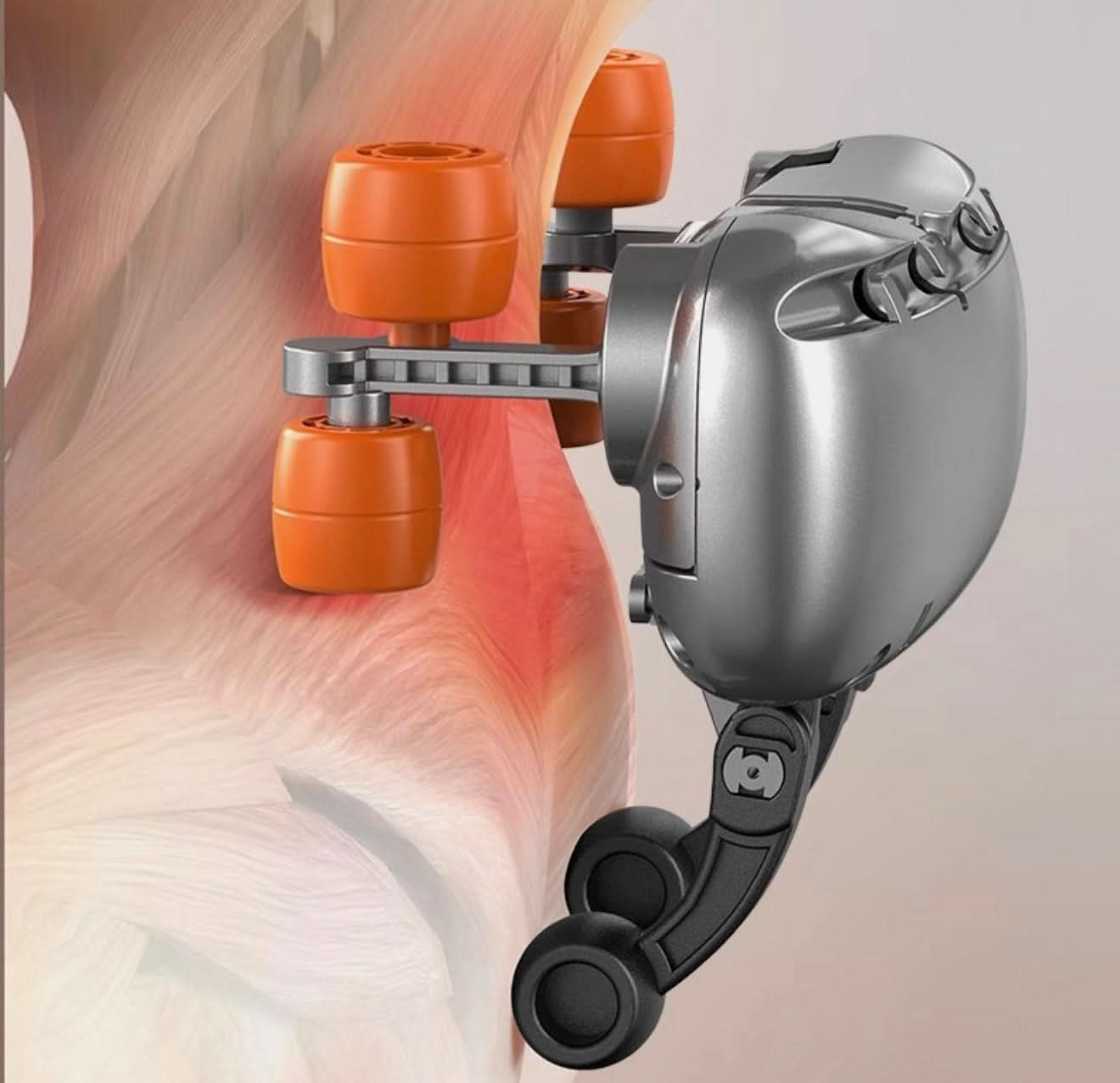 Mechanical device with orange components on a medical illustration of a shoulder